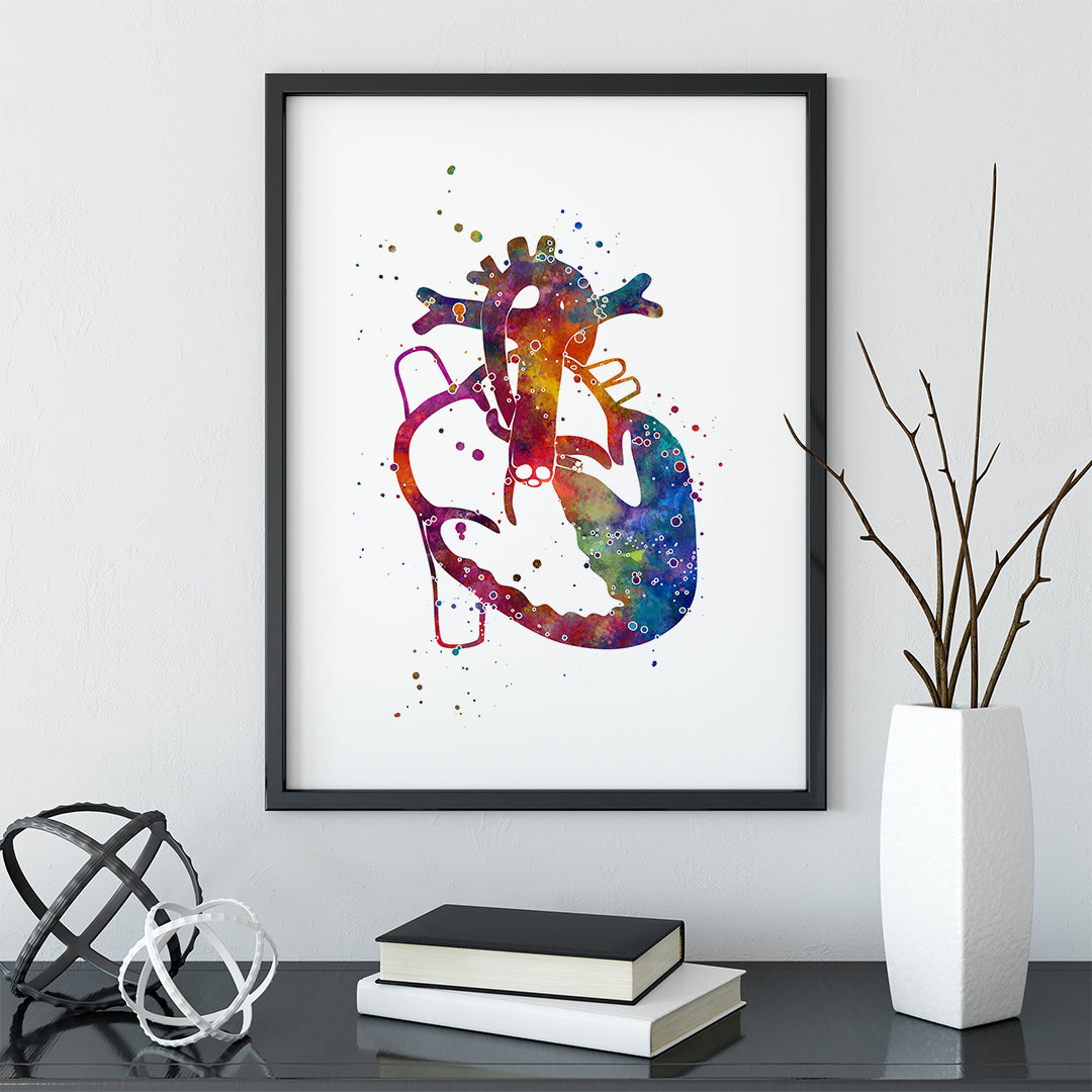 Hypoplastic Left Heart Syndrome Print